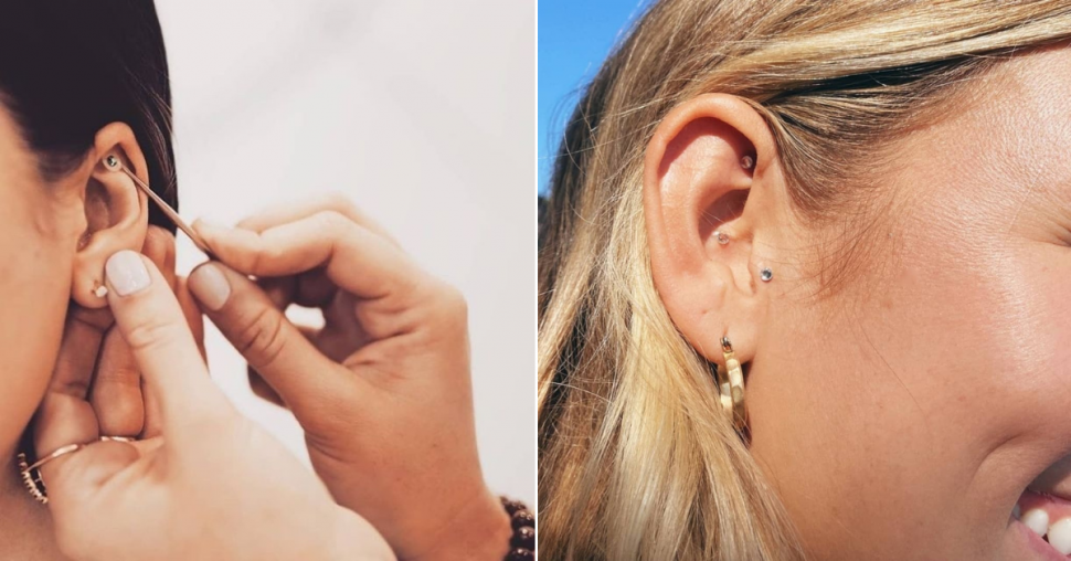 Ear seeds : quelle est cette nouvelle tendance qui aide à lutter contre le stress ?